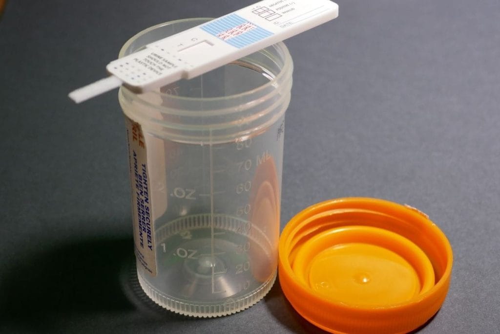 drug testing for kratom